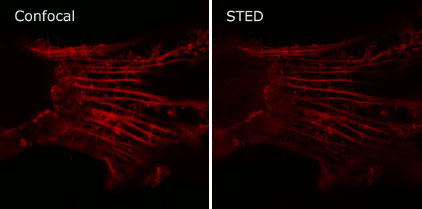 Red confocal and STED superresolution images
