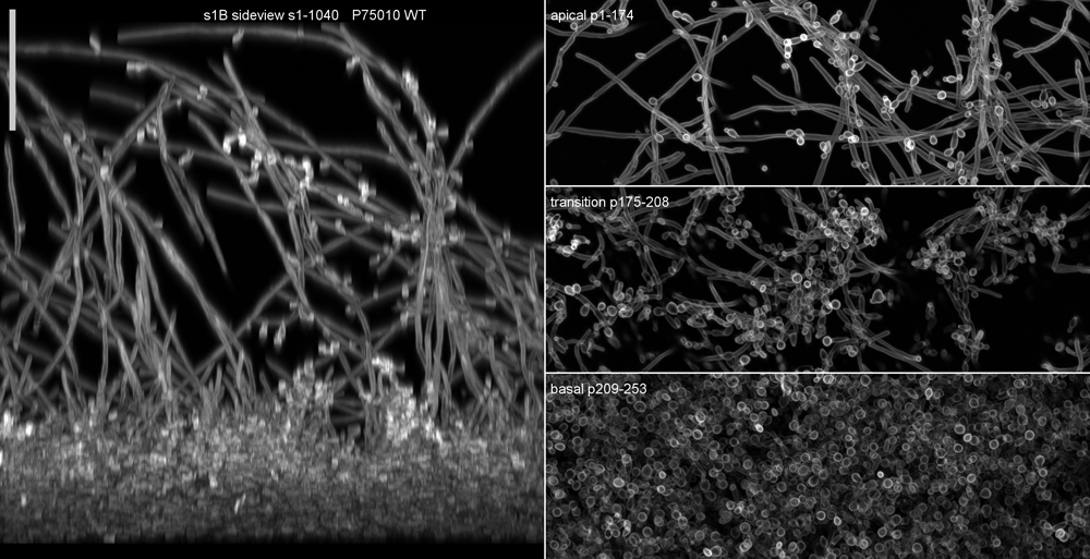 Biofilm structure in colonial growth of Candida albicans strain